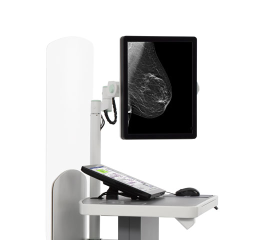 Hologic Clarity HD™ hochauflösende Tomosynthese auf weißem Hintergrund