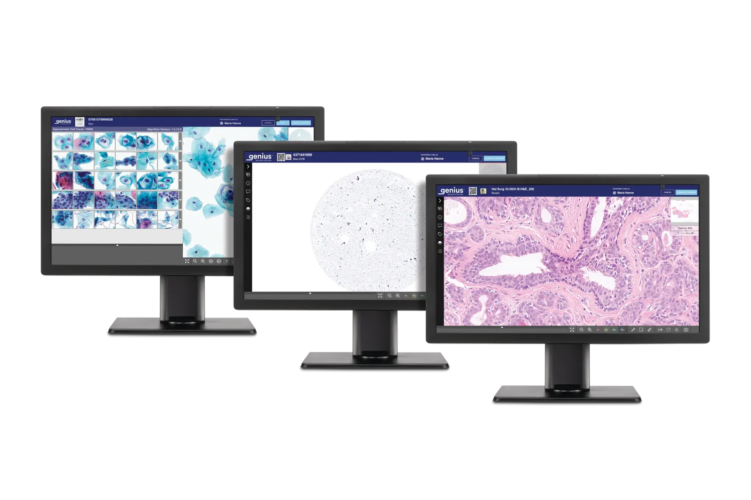 3 Genius-Monitore mit Histologie- und Zytologie-Scans für die Befundung.