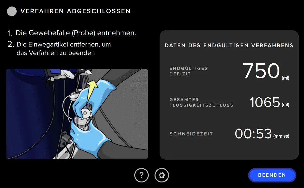 Der Screenshot der Benutzeroberfläche des Fluent Pro Flüssigkeitsmanagementsystems zeigt die Zusammenfassung des Verfahrens.