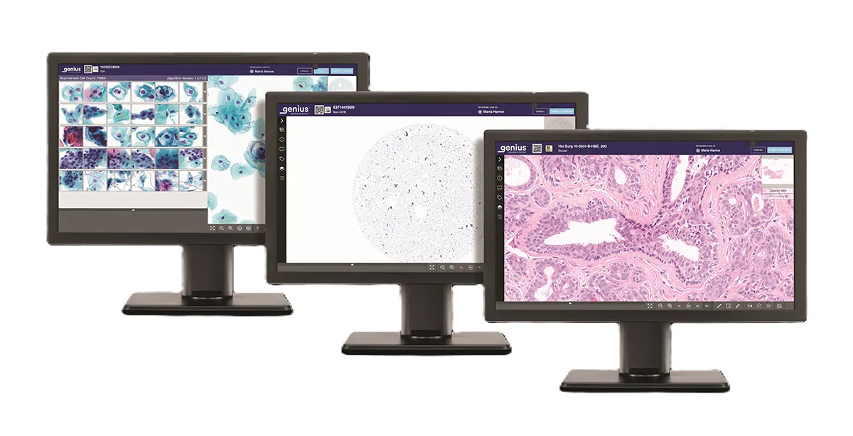 Genius Review station showing diverse sGenius Review Station mit verschiedenen Probentypen (Gyn, NGYN und Histologie)