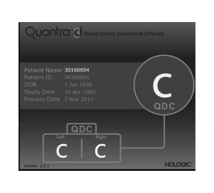 Hologic Quantra™ Technologie vor weißem Hintergrund