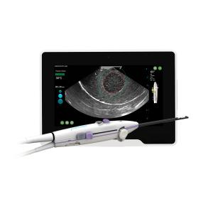 Das Sonata-System ist ein minimalinvasives Gerät mit SMART-Tablet zur Behandlung von Uterusmyomen.
